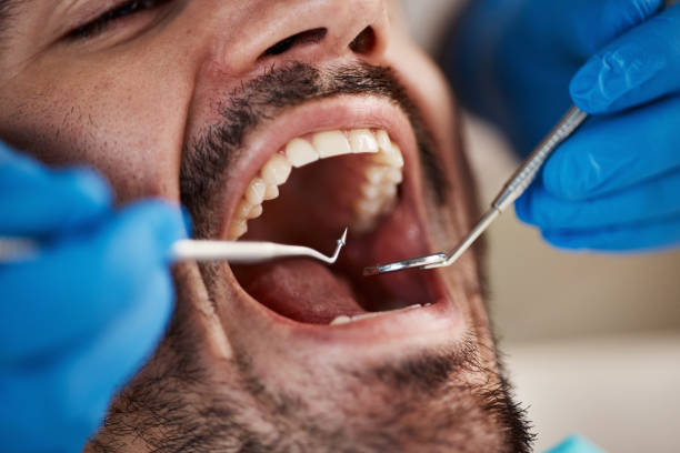 Best Emergency Dentist for Knocked-Out Tooth in Morningside, MD