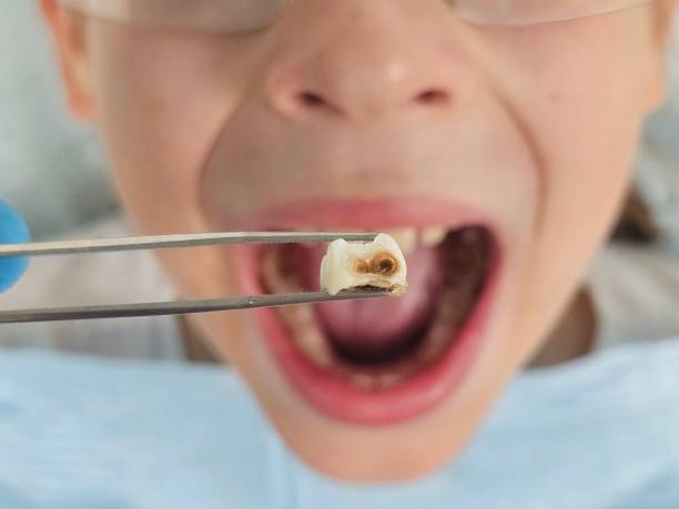 Best Mobile Emergency Dentist in Morningside, MD